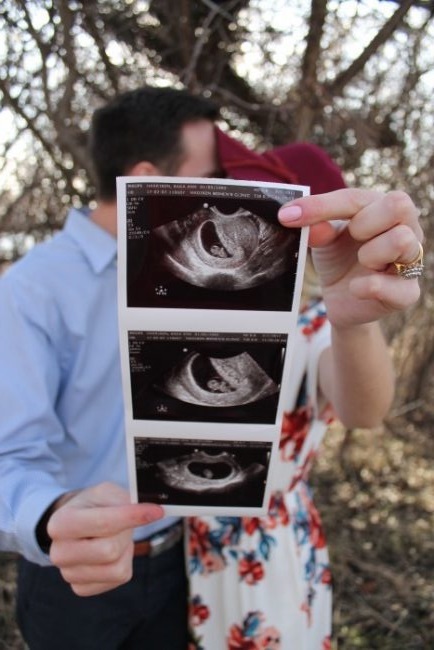 Pregnancy Checklist: Your 2nd Trimester ultrasound