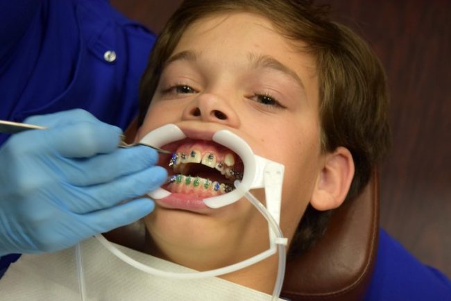 What to Expect at Your First Orthodontist Appointment ES Braces