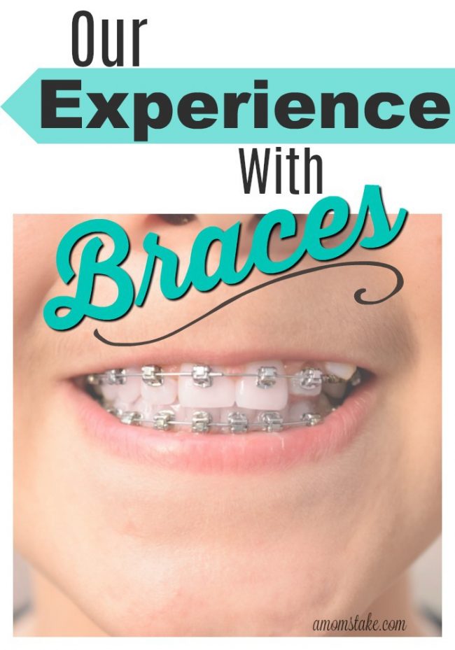 Our Experience So Far With Braces ES Experience with Braces