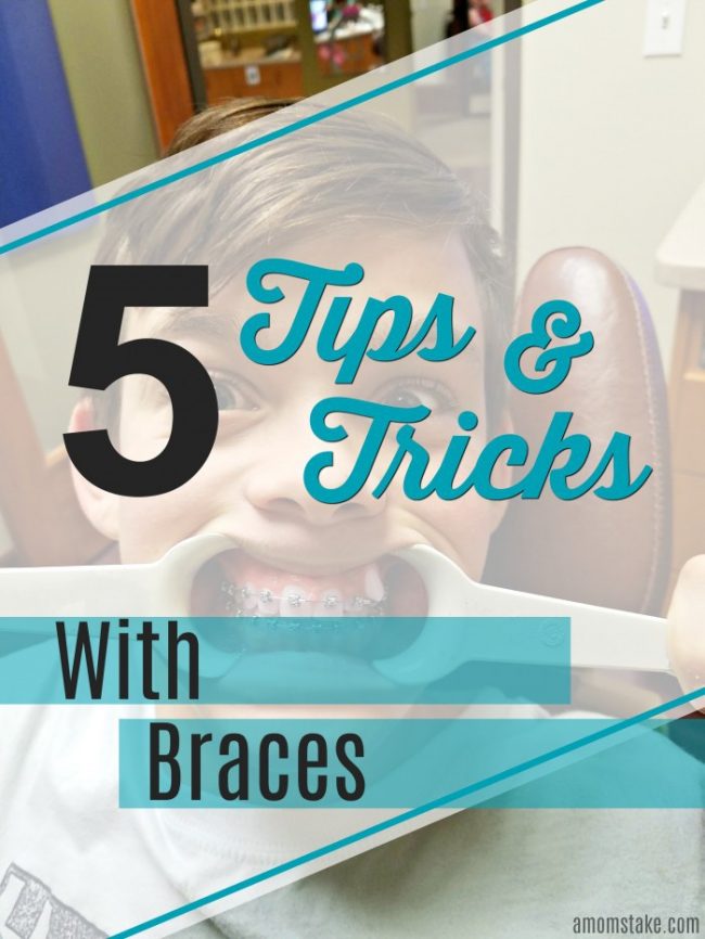 5 Tricks & Tips for Braces Tips and Tricks with braces